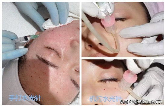 打水光针要问清楚什么,打水光针应该去哪里打好