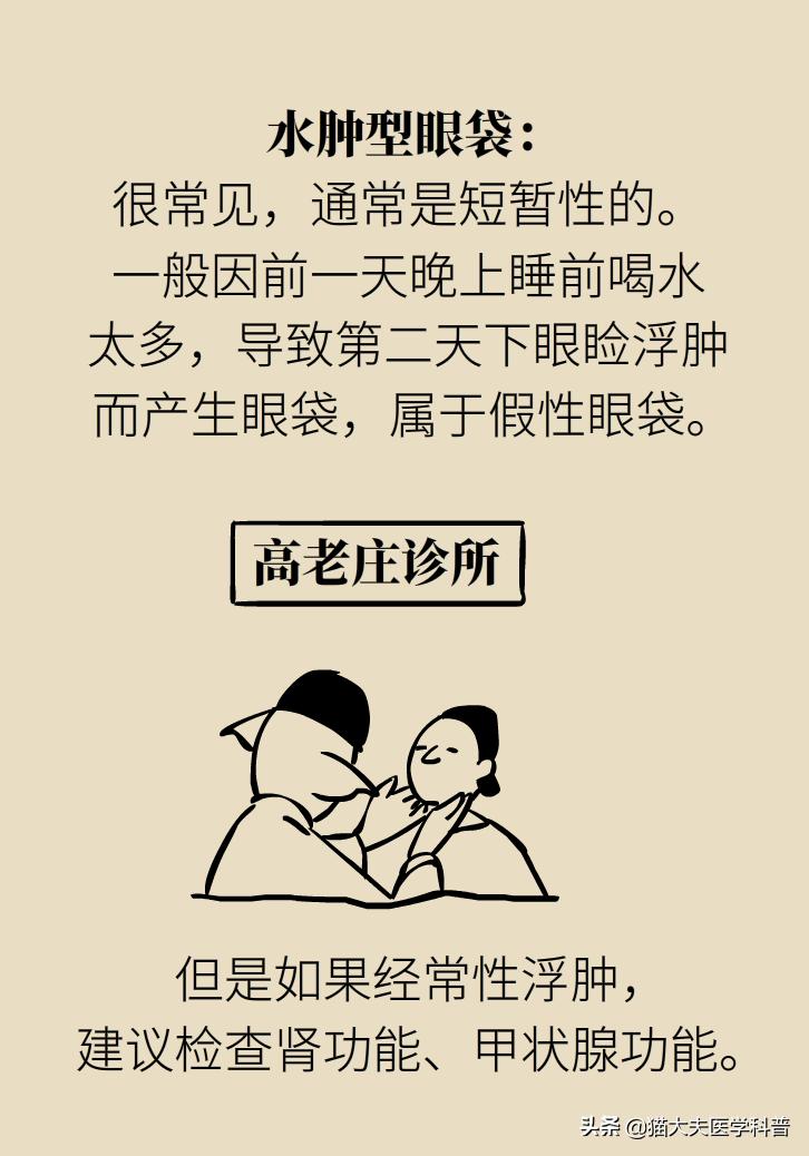 有眼袋怎么办五种去眼袋秘方,眼袋重最简单的去眼袋的方法