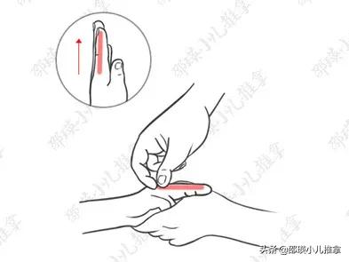 宝宝2岁青蛙肚要多久才能消失,儿童青蛙肚怎么解决