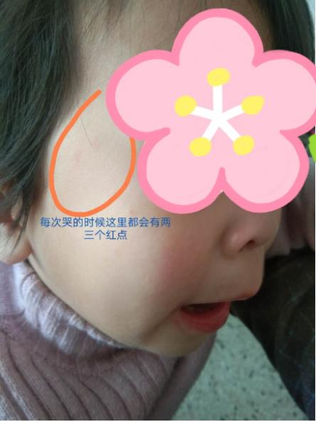 积食不化、反复发热、蒸笼头，问题这么多，从哪里入手好得快