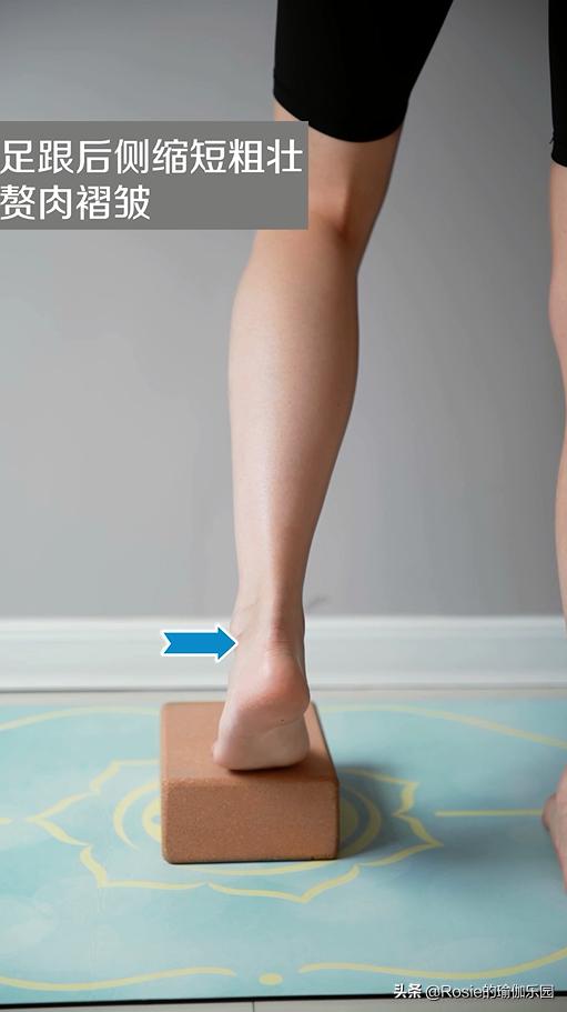 脚踝受限跛脚如何纠正,脚受伤后怎么锻炼脚踝的灵活性