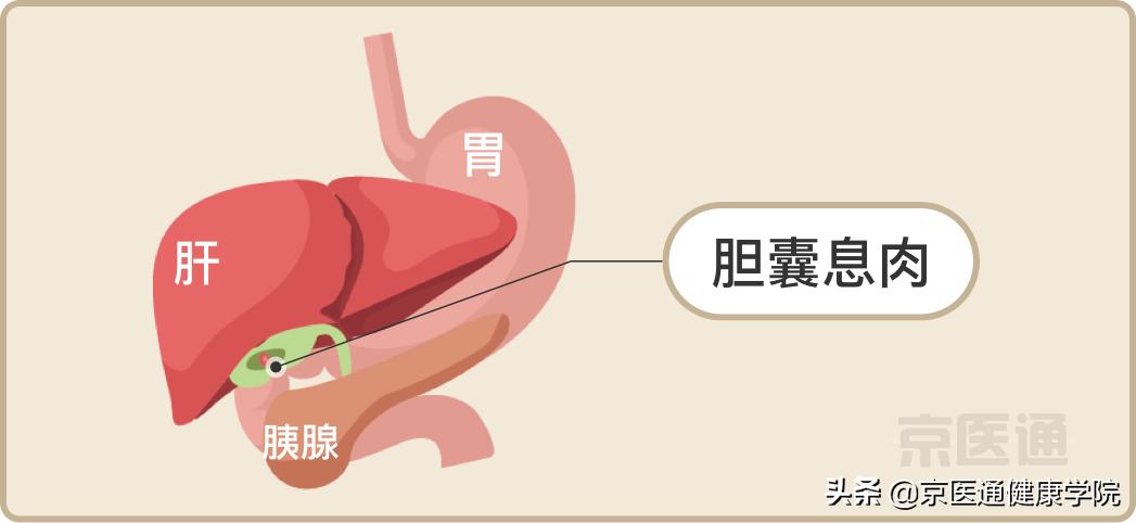 升结肠0.4息肉是癌的可能性是多少,胃体多发息肉0.2-0.4是癌吗