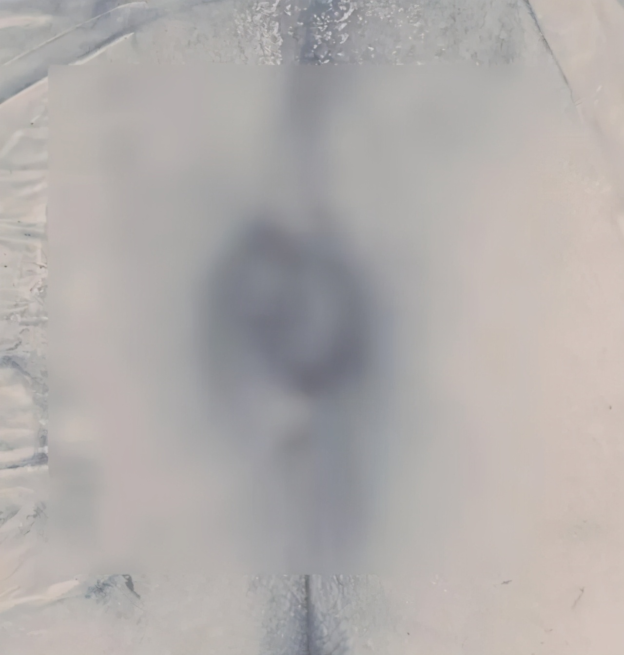 菊花根治肛肠病,菊花有修复术吗