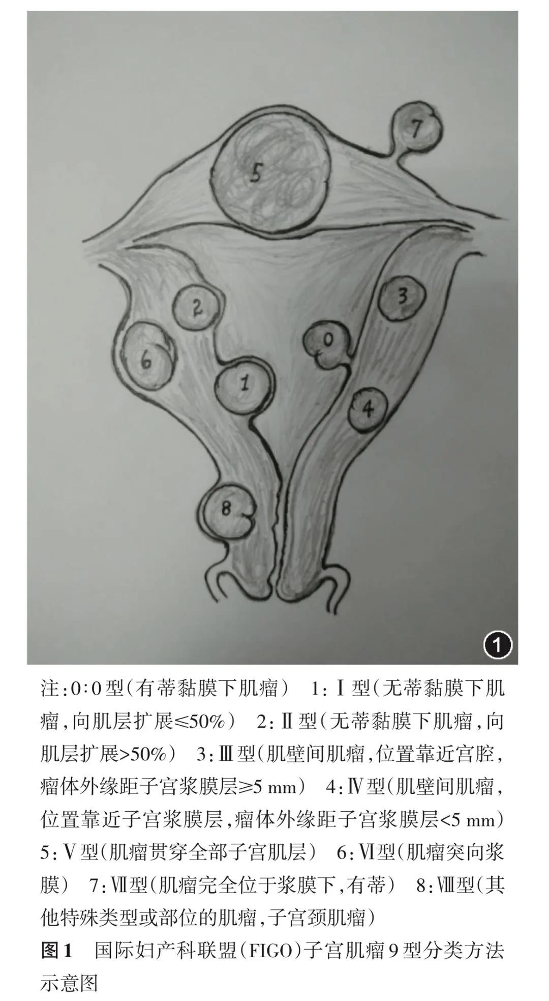 没注意阴道分泌物的这个状况，我差点失去了子宫