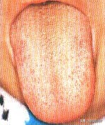 一招教你看舌苔6种舌苔你是哪种,身体好不好看嘴唇就知道了