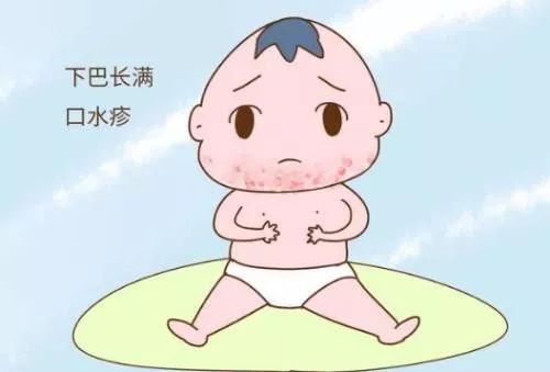 宝宝脸蛋出现红一片和白一片,宝宝口水疹下巴红了一脸蛋怎么办