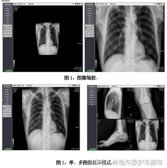 车载dr设备品牌推荐,车载dr的好处和坏处