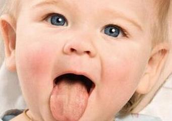 舌苔厚黄有几大症状,不妨自己对照诊断一下