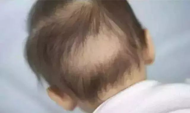 新生儿特有12个生理现象，统统都是正常的，爸妈不必太担心！