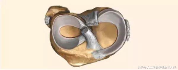 半月板撕裂保守治疗哪个膏药好,半月板后角撕裂的最好治疗方法