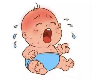 宝宝湿疹妈妈怎么处理好,婴儿湿疹的护理与预防方法