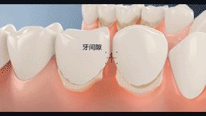 清洁钻石的方法,清洁钻石