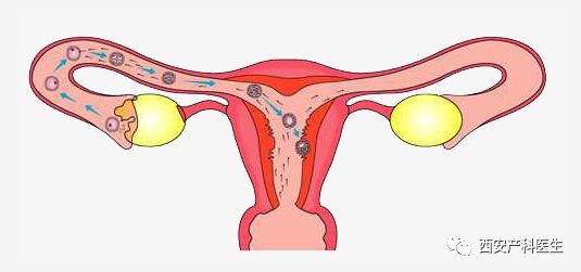 小俩口总是怀不上孩子,到底是谁的错?