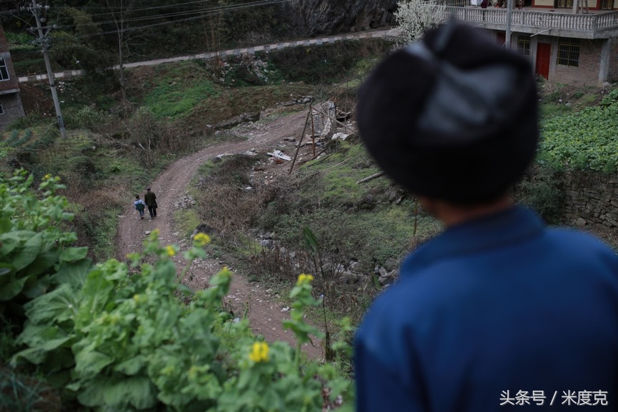 唇腭裂变帅,变帅的孩子