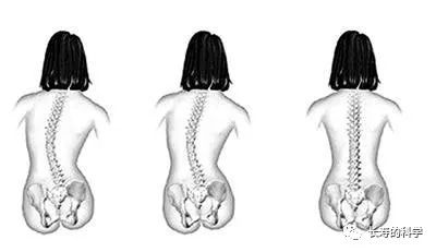 看看你的脊椎到底健不健康？