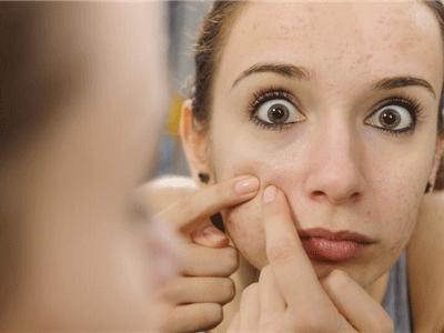 适合湿敷的去闭口的水推荐,一个星期祛闭口