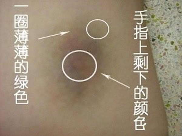 装病请假必备技巧