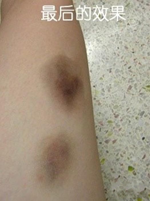 装病请假必备技巧