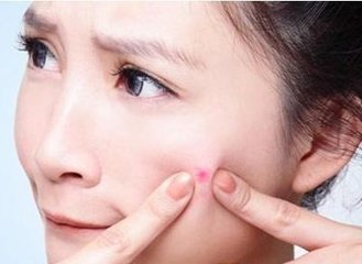 消除痘痘的药膏使用方法,消除疖肿痘痘的正确方法
