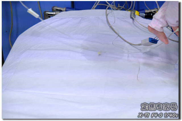 不懂中医怎么看手相,会得大病的手相掌纹