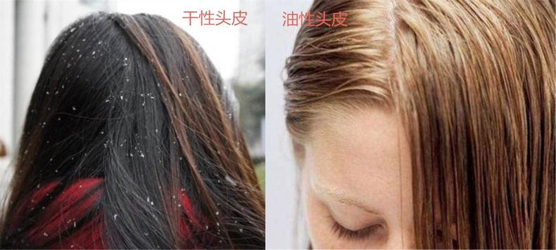 发质干枯留长发该怎么办,头发严重分叉干枯怎么补救