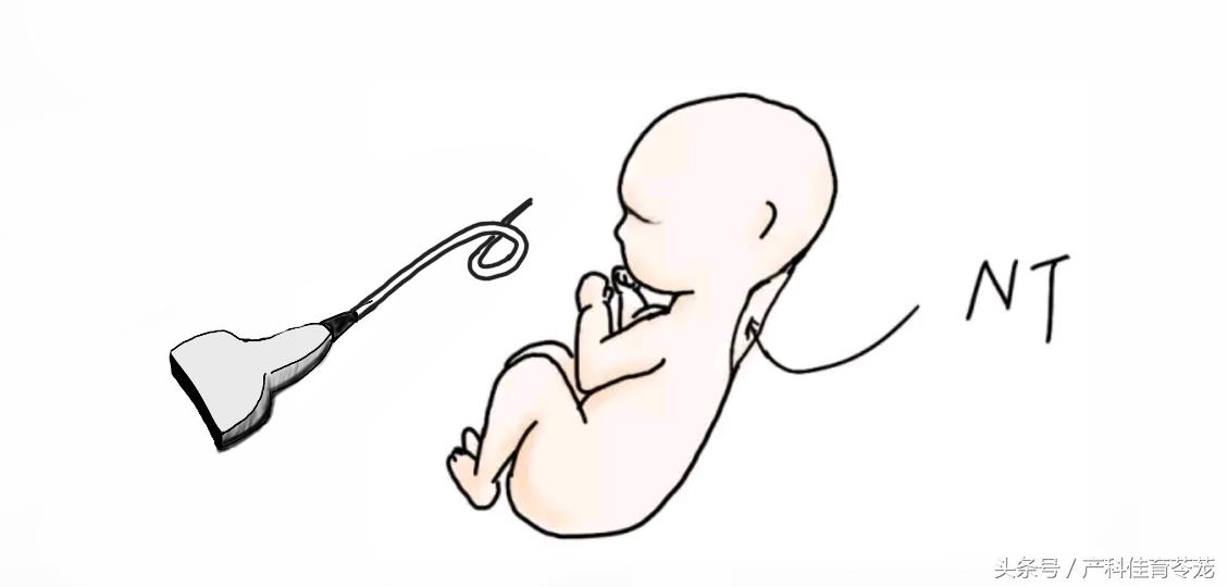 孕期肥胖吃什么食物,孕期要怎样预防发胖