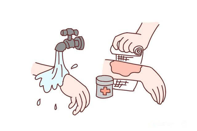 4岁男童烫伤后续,婴儿烫伤脱皮属于几度烫伤