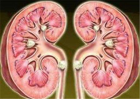 b超检查双肾盂分离,b超胎儿双肾盂分离8mm是什么意思