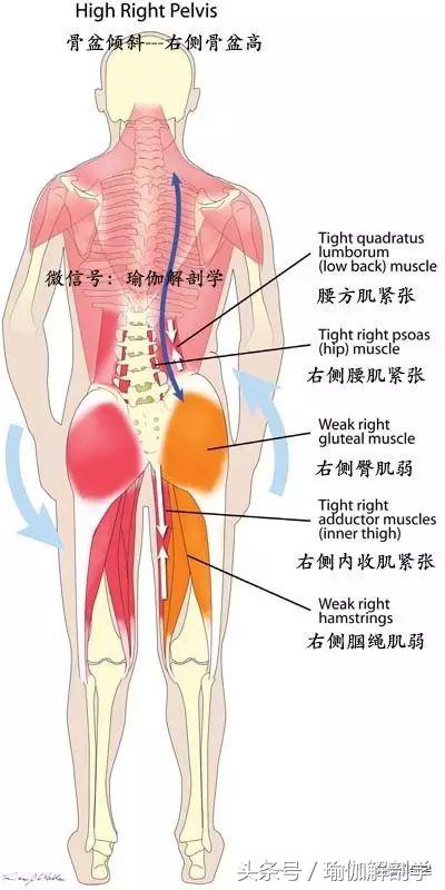 骨盆歪斜导致身体歪斜,骨盆歪斜瑜伽修复