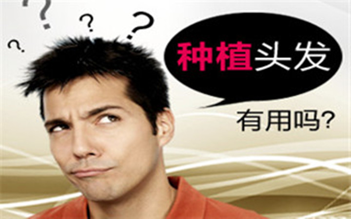 种植头发有用吗,种植头发哪家好