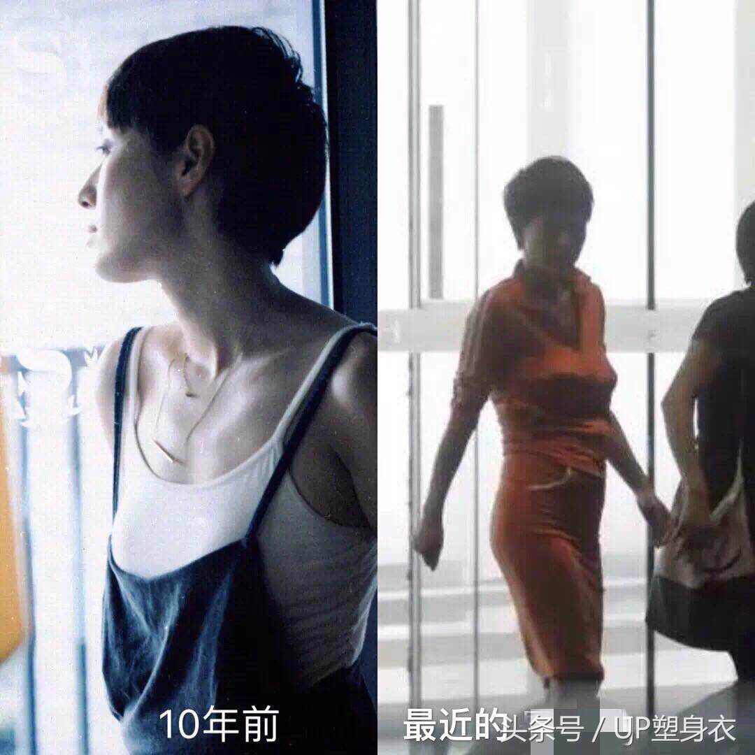 预防产后胸部下垂,胸部下垂怎么办只需四招快速解决