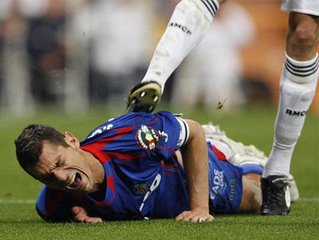 足球被爆头,足球守门员被爆头