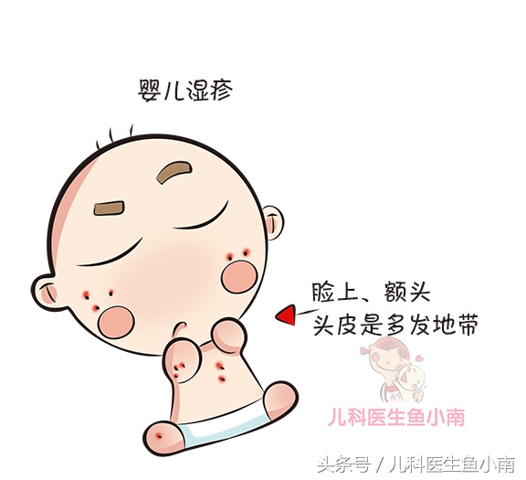 宝宝湿疹和热疹的区别和护理,宝宝湿疹和热疹怎么区分如何护理