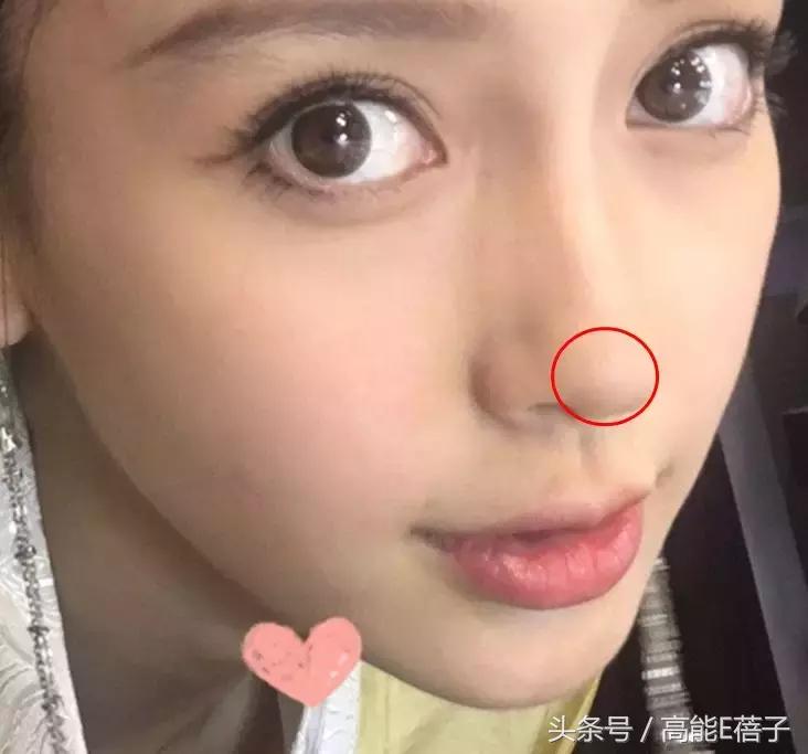 别傻了！蔡徐坤、Angelababy都根治不掉的黑头，微商神器能去除？