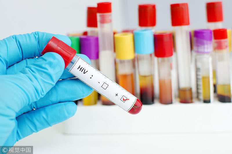 香港大学艾滋病疫苗研发最新消息,香港大学研究艾滋病新药视频