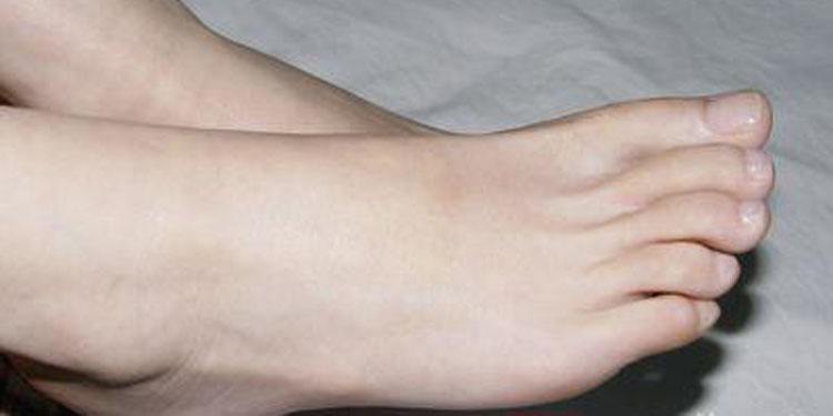 脚上磨出的水泡怎么处理好得快,脚上磨出的水泡怎么消得快