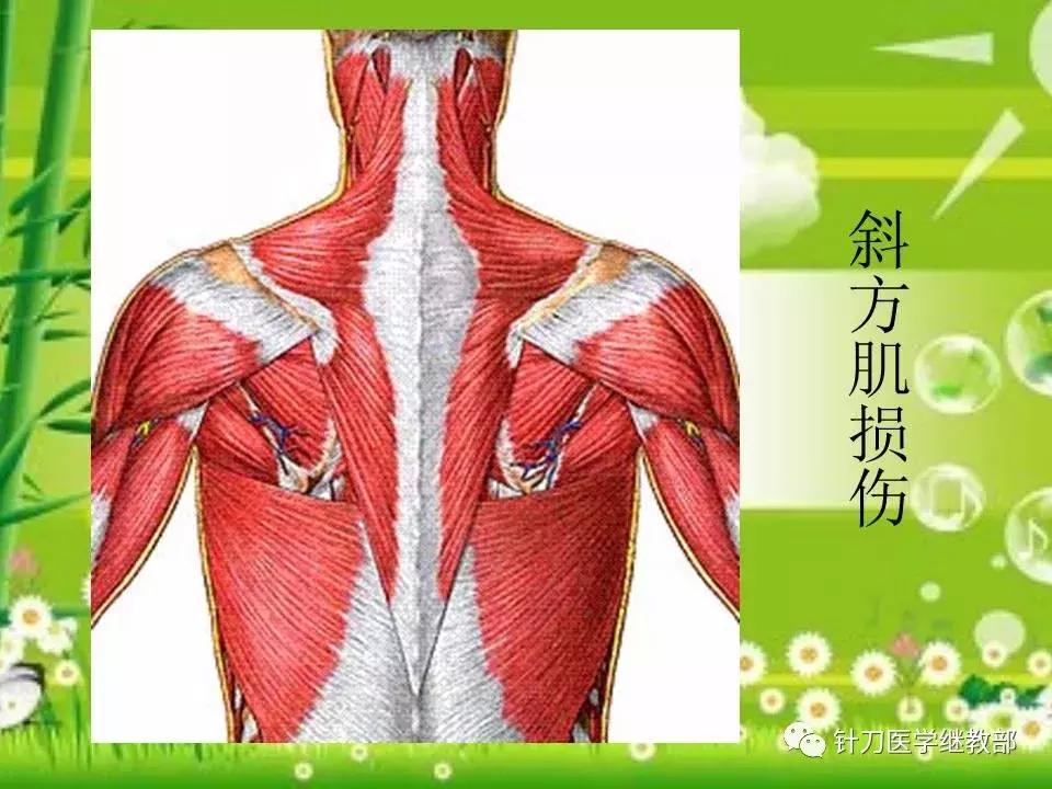 颈椎肌肉损伤用小针刀治疗,针刀治疗颈椎导致神经损伤