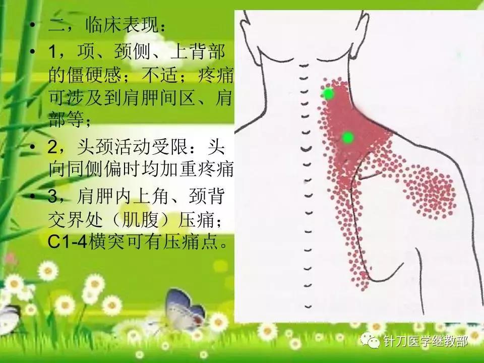 颈椎肌肉损伤用小针刀治疗,针刀治疗颈椎导致神经损伤