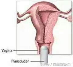 女性妇科检查可以查出有几个男人,35岁女性每隔多久做一次妇科检查