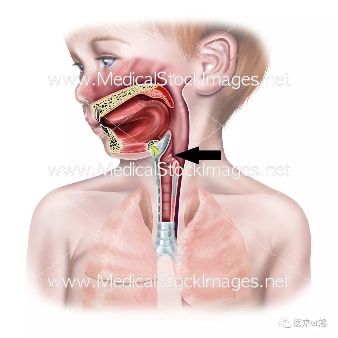 感冒流鼻涕咳嗽怎么办快速解决,风寒感冒咳嗽流鼻涕三招解决