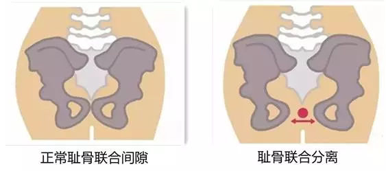 产后各种痛,产后各种痛苦的表现