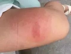 骞夸笢鏆撮洦鑲囧簡闃茬┖璀︽姤,鑲囧簡骞垮畞鏆撮洦琚嚮