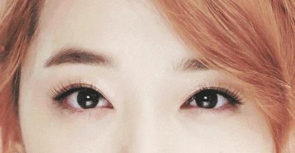 长期佩戴美瞳血管长到黑眼球附近,戴美瞳眼球上长了毛细血管