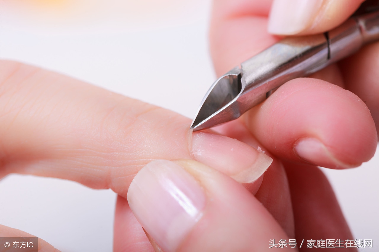 指甲盖掉了怎么处理恢复得快,指甲盖掉了用什么药才能好得快