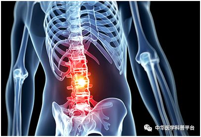 腰背部疼痛什么原因引起的,腰上背部疼痛是什么原因