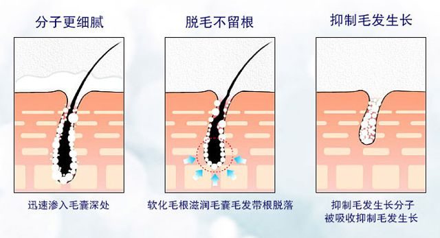 除毛膏永久去除,彻底去除毛根的脱毛膏
