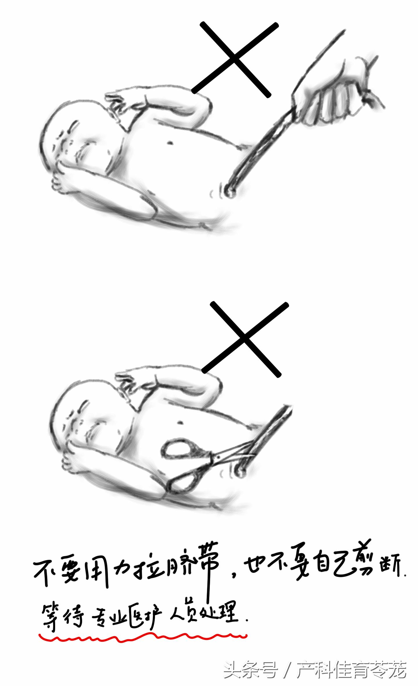 来不及去医院生娃?这套图留着应急