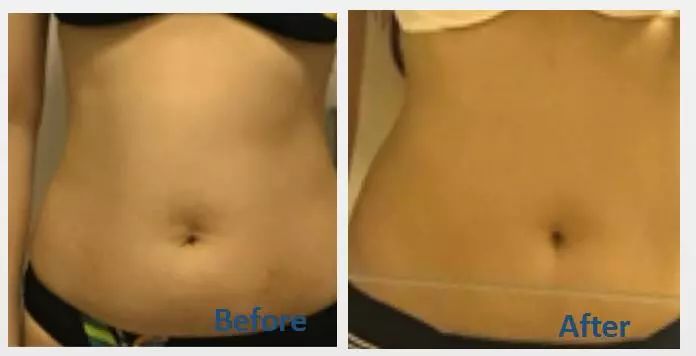 女子肚子燃脂最快的方法,女生燃脂肚子最有效动作