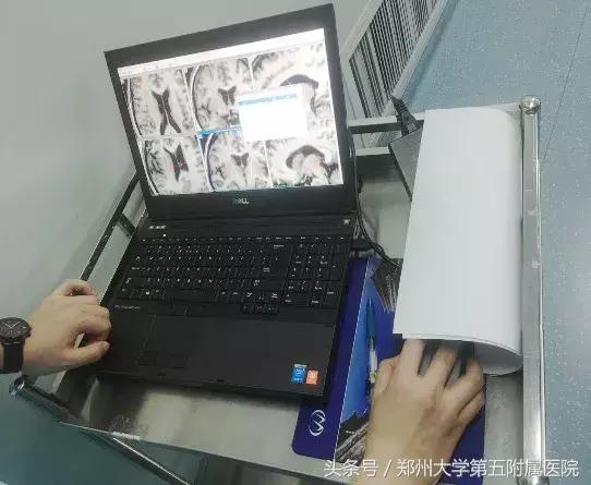 郑州大学第一附属医院治疗帕金森,郑州大学五附院脑梗康复治疗