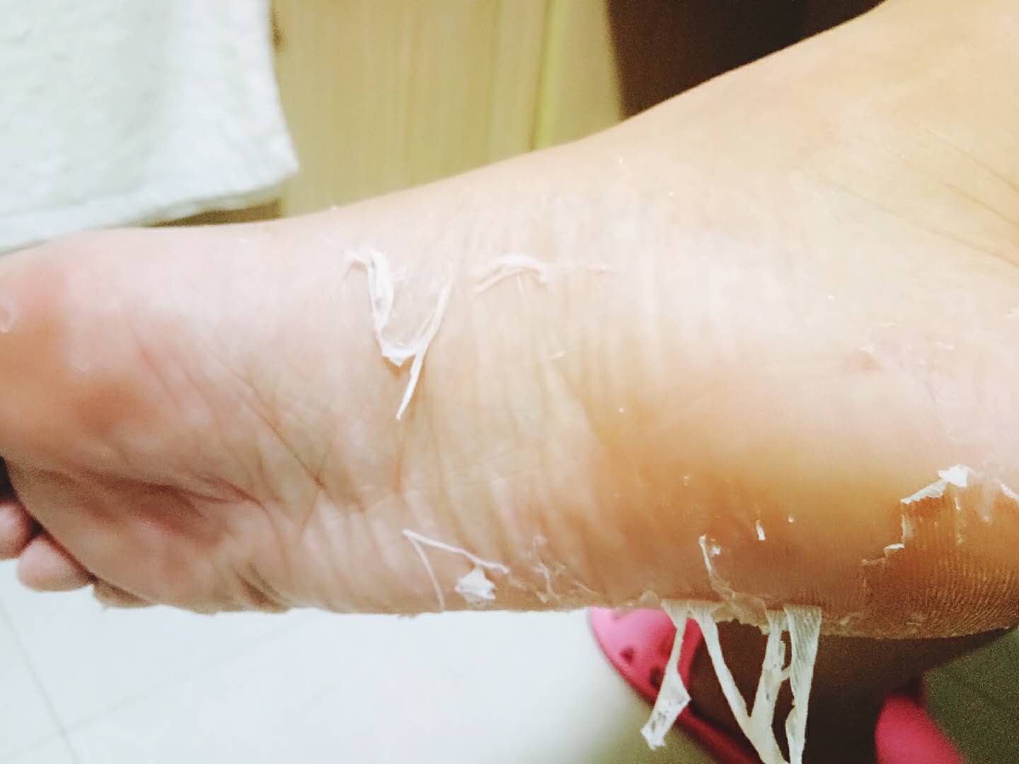 我的去足底死皮之路（sorry啊，这好像是一篇有“味道”的文章）